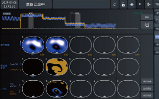 θŹ